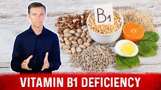 Top Signs and Symptoms of Vitamin B1 Deficiency – Dr Berg [upl. by Arytal833]