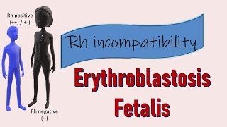 Rh incompatibility II Erythroblastosis fetalis II Prevention with Rhogam [upl. by Ruffin]