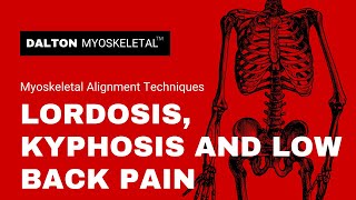 Lordosis Kyphosis and Low Back Pain [upl. by Paulsen791]