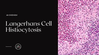 What is Langerhans Cell Histiocytosis [upl. by Eelik]