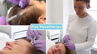 Hair Loss Mesotherapy  The Laser and Skin Clinic [upl. by Markiv]