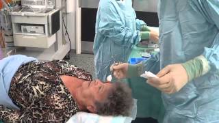 Cataract Surgery Video [upl. by Abe]