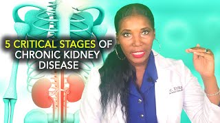 Stages of Chronic Kidney Disease CKD [upl. by Lehcer]