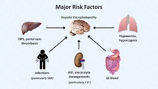 Hepatic Encephalopathy [upl. by Annaigroeg]