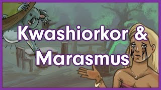 Kwashiorkor vs Marasmus  Nutrition Mnemonic [upl. by Etac]