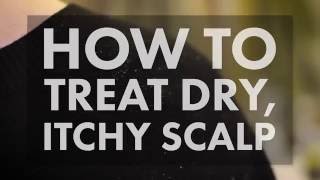 How to Treat a Dry Itchy Scalp  WebMD [upl. by Akener302]