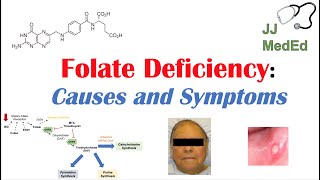 Folate Deficiency Causes ex medications Pathogenesis Symptoms Diagnosis and Treatment [upl. by Ruckman]