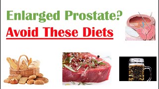 Foods to Avoid with Enlarged Prostate  Reduce Symptoms and Risk of Prostate Cancer [upl. by Arbuckle287]