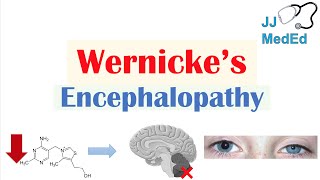 Traumatic Brain Injury Timeline Animation Charts Encephalomalacia [upl. by Sinnoda]