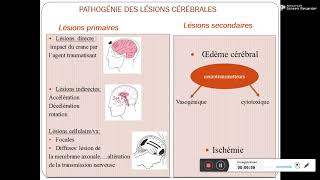 Traumatisme cranien Pr Daoud [upl. by Tyrone]