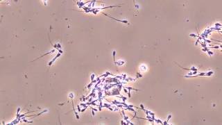 Moving pig sperm observed by biological [upl. by Hanikehs]